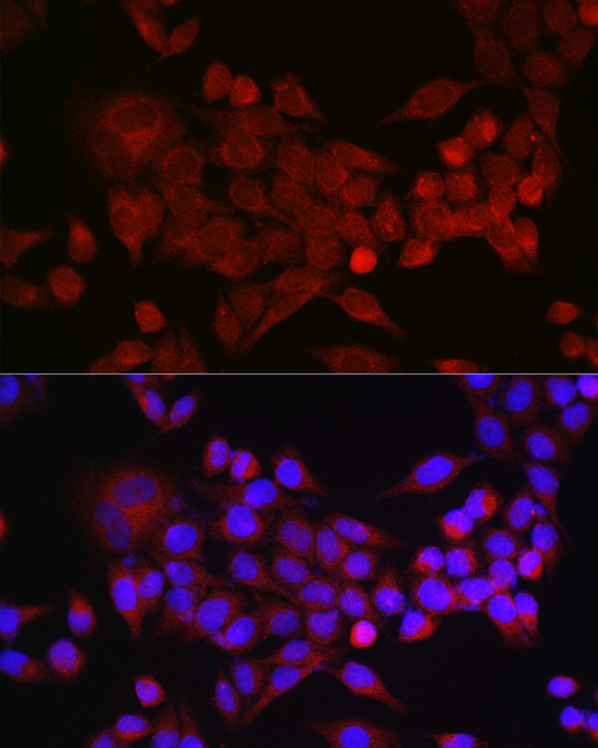 Inhibin beta A (INHBA) Rabbit polyclonal antibody