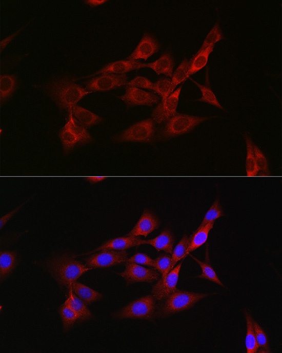 Inhibin beta A (INHBA) Rabbit polyclonal antibody