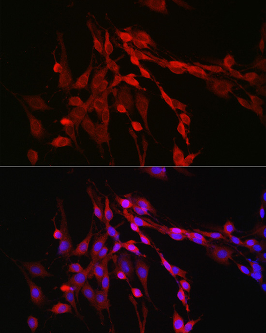Inhibin beta A (INHBA) Rabbit polyclonal antibody