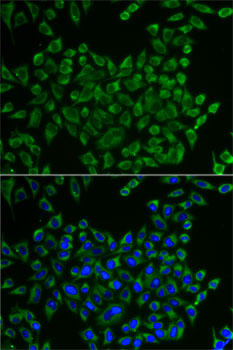 MRPS30 Rabbit polyclonal antibody