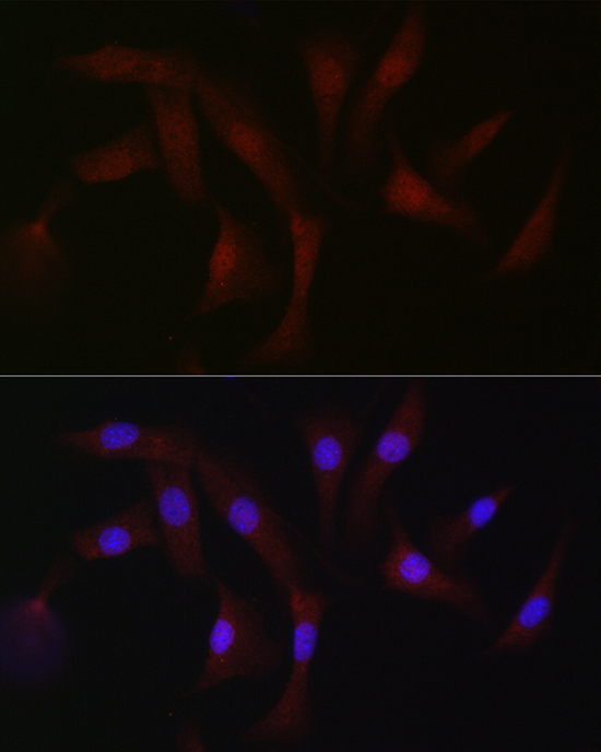 PKC-beta Rabbit polyclonal antibody
