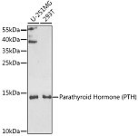 Western blot - Parathyroid Hormone (PTH) Rabbit pAb (A5846)