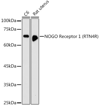 NOGO Receptor 1 (RTN4R) Rabbit polyclonal antibody