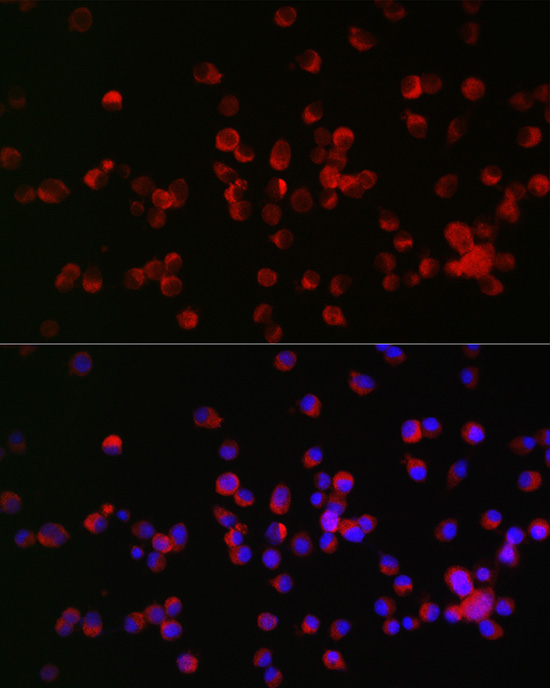NOGO Receptor 1 (RTN4R) Rabbit polyclonal antibody