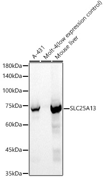 SLC25A13 Rabbit polyclonal antibody
