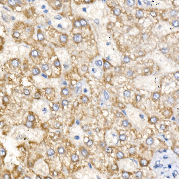 SLC25A13 Rabbit polyclonal antibody