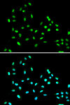 Immunofluorescence - SMARCAD1 Rabbit pAb (A5850)