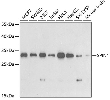 SPIN1 Rabbit polyclonal antibody