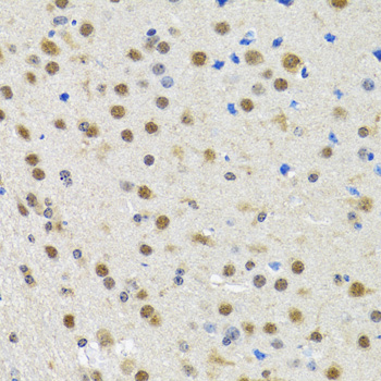 SPIN1 Rabbit polyclonal antibody