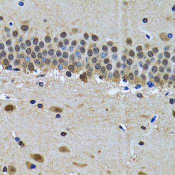 SPIN1 Rabbit polyclonal antibody