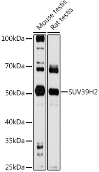 SUV39H2 Rabbit polyclonal antibody