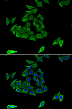 TGM3 Rabbit polyclonal antibody