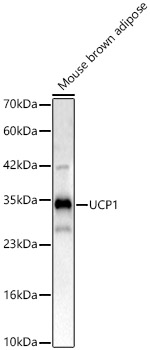 UCP1 Rabbit polyclonal antibody