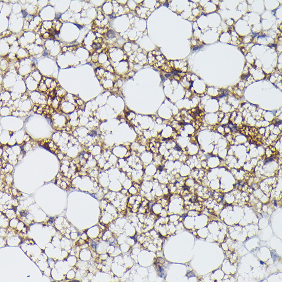 UCP1 Rabbit polyclonal antibody