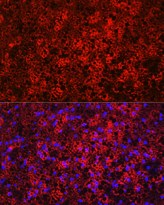 UCP1 Rabbit polyclonal antibody