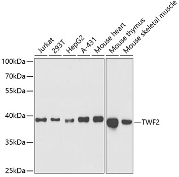 TWF2 Rabbit polyclonal antibody