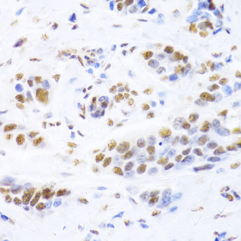 Ku80 Rabbit polyclonal antibody