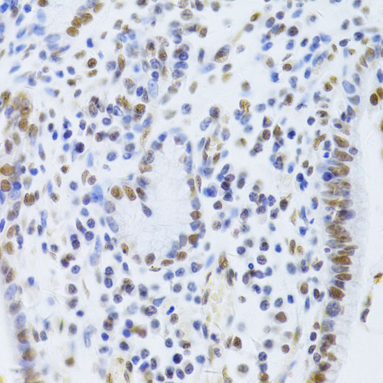 Ku80 Rabbit polyclonal antibody