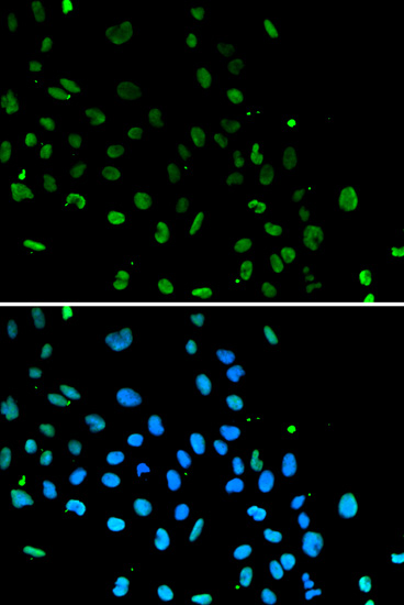 Ku80 Rabbit polyclonal antibody
