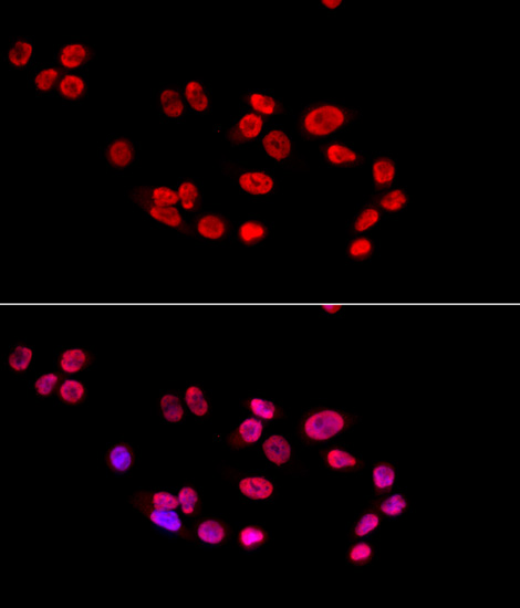 Ku80 Rabbit polyclonal antibody