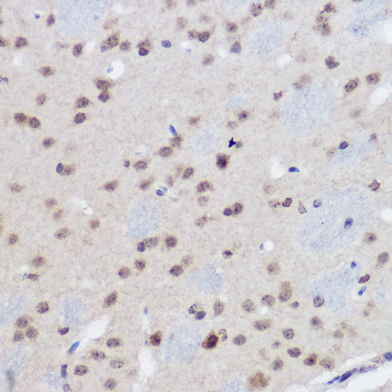 PLZF Rabbit polyclonal antibody