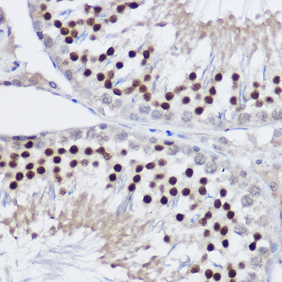 PLZF Rabbit polyclonal antibody
