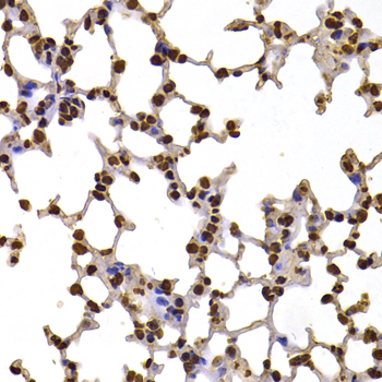 FBXW7 Rabbit polyclonal antibody