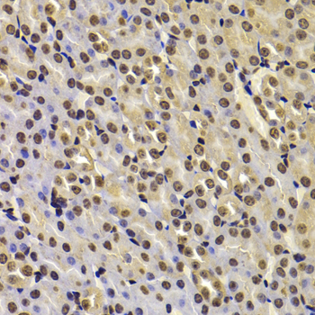 FBXW7 Rabbit polyclonal antibody