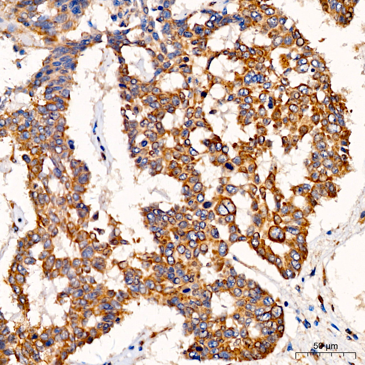 [KO Validated] SND1 Rabbit polyclonal antibody