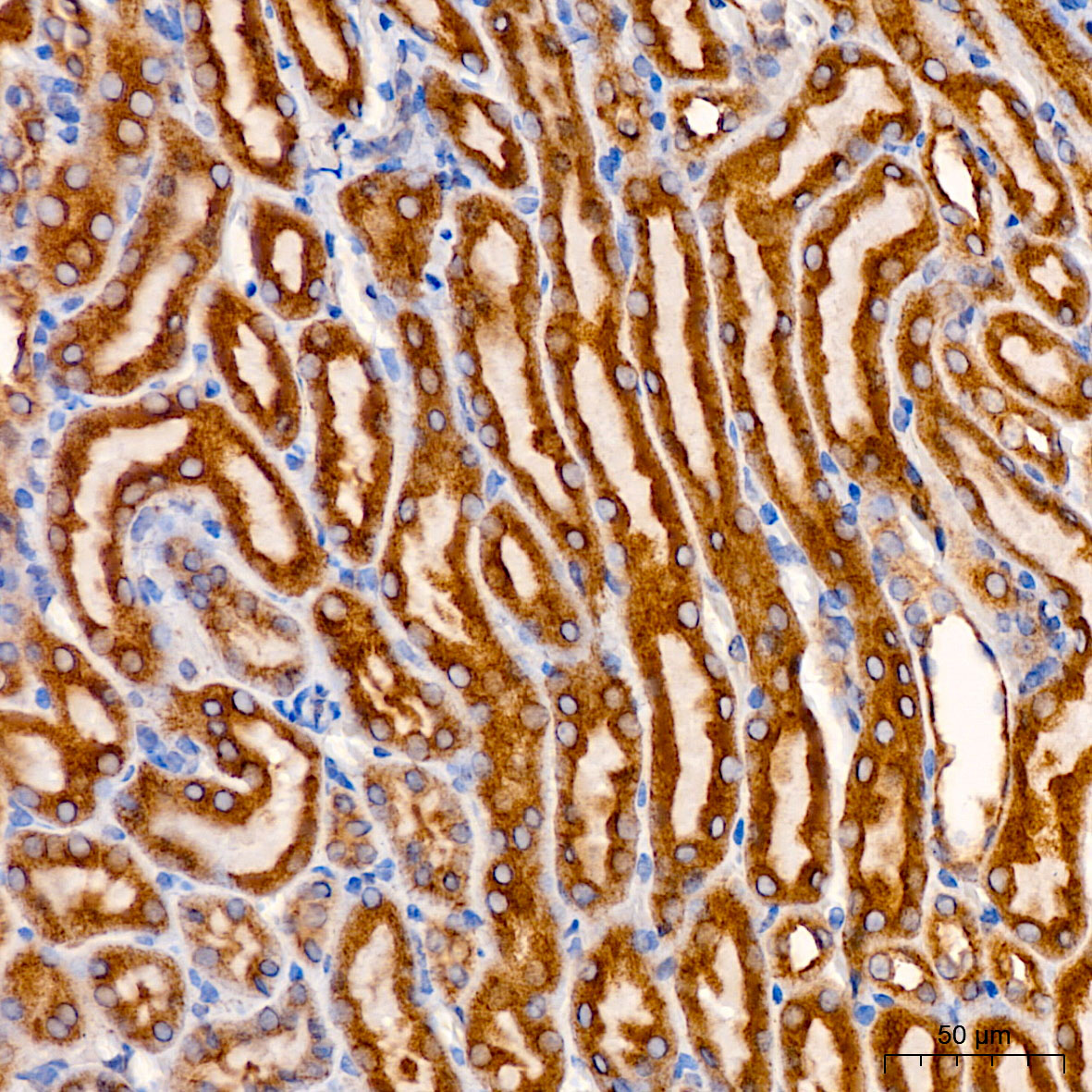 [KO Validated] SND1 Rabbit polyclonal antibody