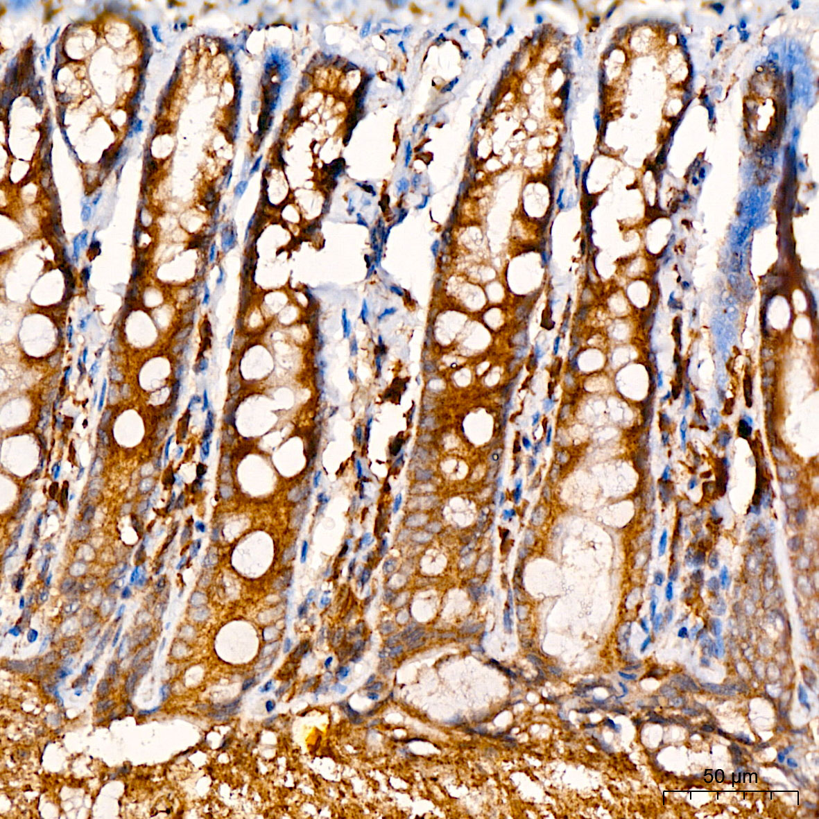 [KO Validated] SND1 Rabbit polyclonal antibody