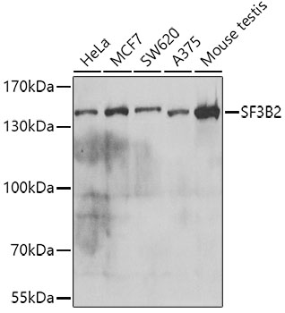 SF3B2 Rabbit polyclonal antibody