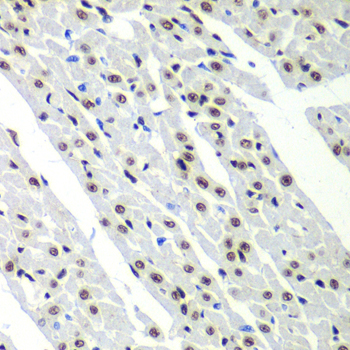 SF3B2 Rabbit polyclonal antibody
