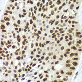 SF3B2 Rabbit polyclonal antibody