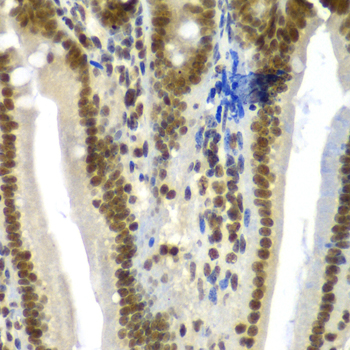 SF3B2 Rabbit polyclonal antibody