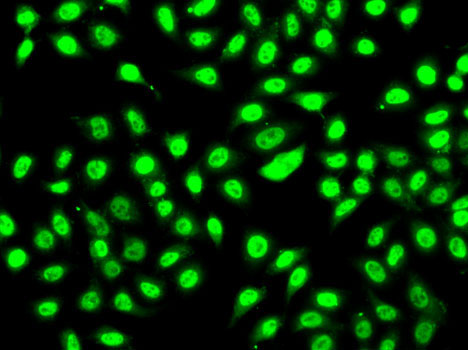 SF3B2 Rabbit polyclonal antibody