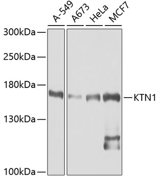 KTN1 Rabbit polyclonal antibody