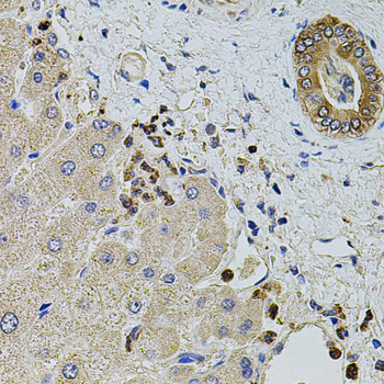 KTN1 Rabbit polyclonal antibody
