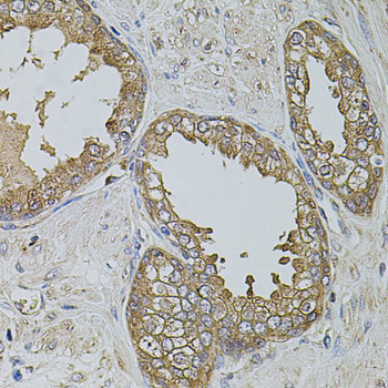 KTN1 Rabbit polyclonal antibody