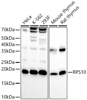 RPS10 Rabbit polyclonal antibody