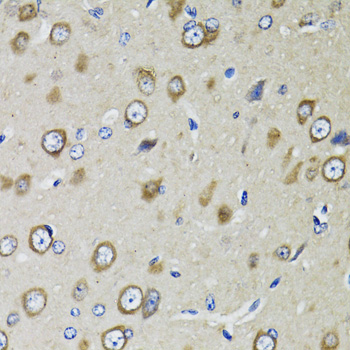 RPS10 Rabbit polyclonal antibody