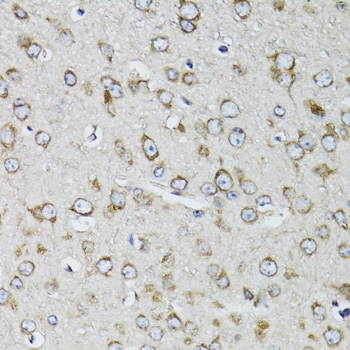 RPS10 Rabbit polyclonal antibody