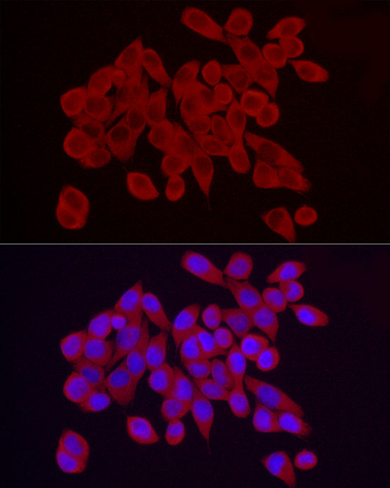 RPS10 Rabbit polyclonal antibody