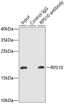 RPS10 Rabbit polyclonal antibody