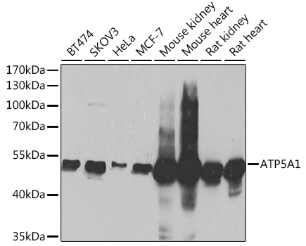 ATP5A1 Rabbit polyclonal antibody