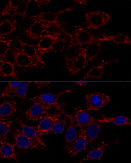 ATP5A1 Rabbit polyclonal antibody