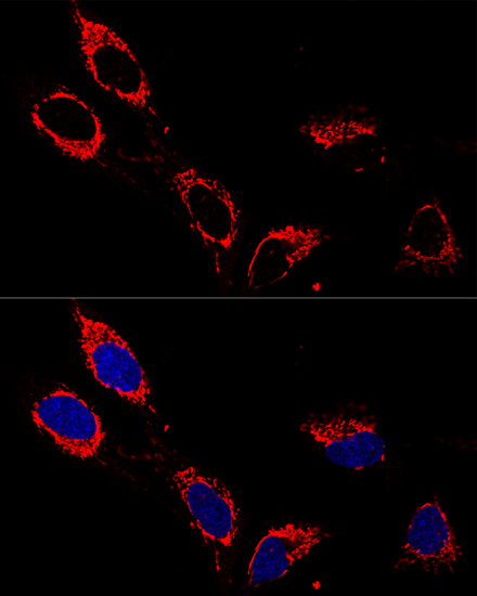 ATP5A1 Rabbit polyclonal antibody