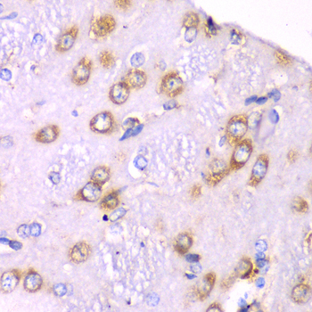 RPS3A Rabbit polyclonal antibody