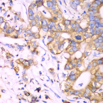 RPS3A Rabbit polyclonal antibody