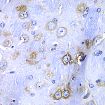 RPS3A Rabbit polyclonal antibody